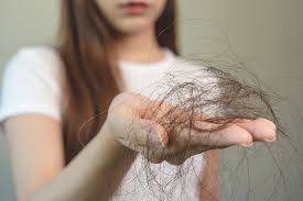 💇‍♀️ علت اصلی ریزش مو در خانم‌ها و راهکارهای واقعی درمان