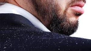 شوره سر، علل و درمان